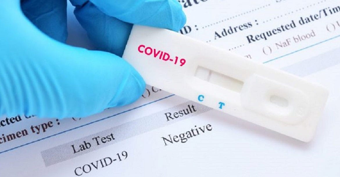 Người nhập cảnh vào Mỹ phải có kết quả âm tính với covid 19